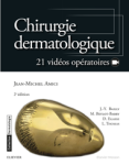 Chirurgie dermatologique vignette
