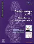 Analyse pratique du RCF vignette
