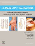 La main non traumatique vignette