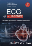 ECG en urgence vignette